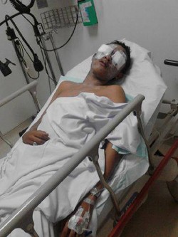 Siswa STM Budi Utomo Disiram Air Keras, Polisi: Dia Korban Tawuran