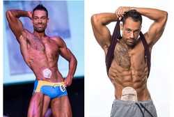Wow! Pria Ini Juarai Kompetisi Model Fitness Meski Pakai Kantong Kolostomi