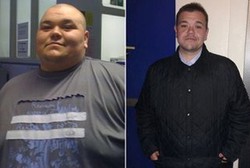 Ada Bekuan Darah di Paru, Penggemar Junk Food Ini Turunkan Bobot 155 Kg