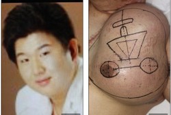 Pria Ini Punya Wajah Buatan Tumbuh di Dada Kirinya