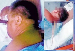 Kepala Tertancap Sebilah Kayu, Pria Ini Tetap Tenang