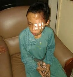 Komnas HAM Minta 3 Nenek Penyiksa Nuryati Dihukum Berat