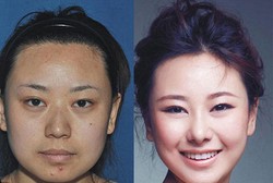 Operasi Plastik di Korea, Bagaimana Para Wanita Ini Lolos Imigrasi Saat Pulang?