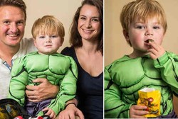 Usia Enam Bulan Sudah Sakit Gula, George Bertahan Hidup dengan Makan Jeli