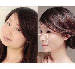 Perubahan Drastis Wajah 8 Wanita China Pasca Operasi Plastik di Korea