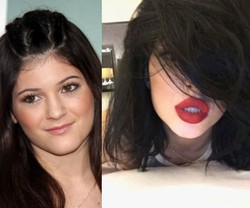 Bantah Operasi Plastik, Kylie Jenner Ungkap Rahasia Miliki Bibir Seksi
