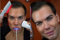 Sudah 12 Kali Operasi Plastik, Pria Ini Belum Puas karena Ingin Mirip Ken Barbie