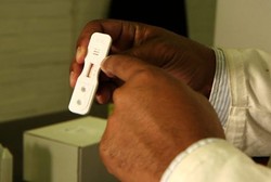 Ilmuwan Afrika Selatan Kembangkan Alat Deteksi Dini Malaria