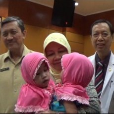 Tak Bisa Dipisahkan, Kembar Siam asal Kediri Dipulangkan