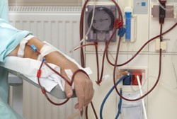 Waspadai, Ginjal Juga Bisa Kena Kista