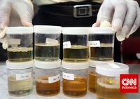 Warga Kampung Ambon Jalani Tes Urine