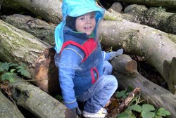 Didiagnosis Penyakit Langka, Sinar Matahari Bikin Balita Ini Kena Kanker