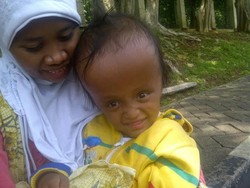 Ini Oktavia, Anak Penderita Hidrosefalus yang Digendong Ibunya Mengemis di Cijantung