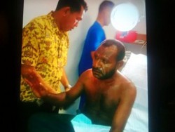Ini Nama Kader Golkar yang Dirawat Karena Adu Jotos di Luar Arena Munas