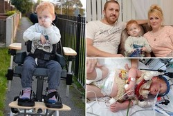 Baru Belajar Berjalan, Bocah Ini Tertabrak Pengemudi Mabuk dan Jadi Lumpuh