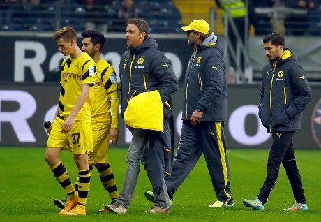 Ingin Segera Bangkit, Klopp: Dortmund Bukannya Mendadak Bodoh dalam Semalam