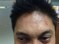 Kasus Pemukulan Petugas Imigrasi, Polisi Kesulitan Periksa Saksi