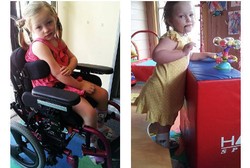 Sindrom Langka Bikin Bocah 5 Tahun Ini Kejang-kejang Hanya karena Kaget