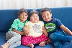 Idap Kelainan Langka, Bayi 10 Bulan Tumbuh Hingga Sebesar Anak 5 Tahun