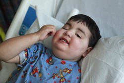 Penyakit yang Sebabkan Bocah Ini Stroke 15 Kali Sehari Telah Terkuak