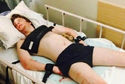 Mengamuk, Pria dengan Autisme Diikat di Tempat Tidur RS Selama 15 Hari