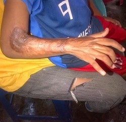 Pemprov Instruksikan Bank Riau Biayai Operasi Bocah Bagas