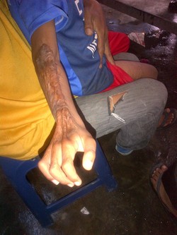 Bank Riau soal Kasus Bocah Bagas: Kami Siap Bantu Dana Operasi Sepenuhnya