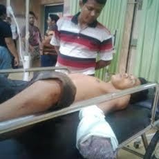 Seorang DPO Terkapar Akibat Bondet yang Dibuat Kejahatan Meledak