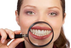 Tonggos, Gingsul dan Gummy Smile, Ini Bedanya