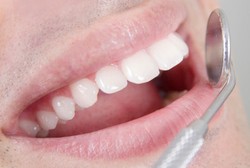 Makin Tua, Gigi Bisa Makin Maju? Begini Penjelasan Dokter