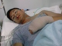 Fero Walandouw Kecelakaan Syuting, Priscil Blink Setia Temani di RS