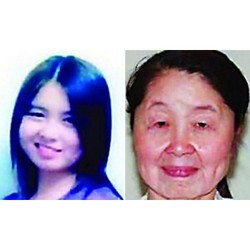 Punya Penyakit Langka, Wanita Muda Ini Terlihat Seperti Nenek 70 Tahun