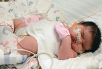 Bertubuh Gempal, Ini Potret Bayi-bayi dengan Bobot di Atas Normal
