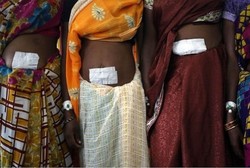 Mabuk Saat Lakukan Operasi Sterilisasi, Dokter di India Diskors