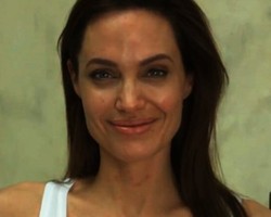 Penampilan Jolie Saat Kena Cacar Air: Cantik