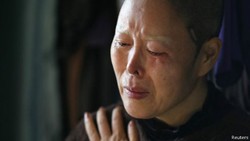 Ini Pengakuan Korban Bisnis Bedah Plastik Korsel