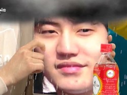 Kyuhyun SuJu Pamer Wajah Sebelum Operasi Plastik