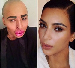 Foto: Penampilan Pria yang Habiskan Rp 1,9 Miliar Demi Mirip Kim Kardashian