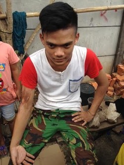 Coba Selamatkan Diri dari Kebakaran Tambora, 2 Orang Alami Luka Bakar