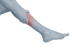 Konsultasi Tulang: Menghindari Nyeri Tumit dan Kram Usai Olahraga