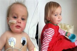 Masih Misteri, Penyebab Si Kecil Wyatt Tak Bisa Buka Mulut