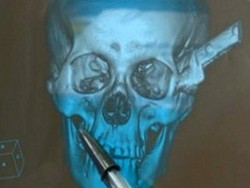 Ngerih, Pria Ini Kendarai Motor dengan Kepala Tertusuk Pisau