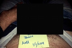 Pria dengan Kemaluan Ganda Terbitkan Buku, Isinya Curhat Kehidupan Seksual