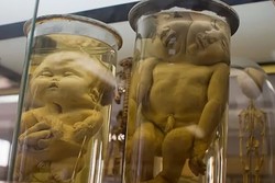 5 Museum Seram yang Berisi Organ Tubuh Manusia