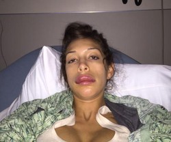 Suntik Bibir Agar Seksi, Bintang Porno Ini Malah Jontor