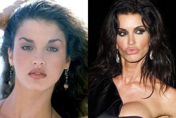 Ingin Seksi, Injeksi Bibir Malah Membuat Wajah 7 Selebriti Ini Menyeramkan