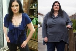 Kena Penyakit Misterius, Tubuh Pell Membengkak dan Naik Bobot 51 Kg