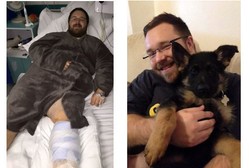 Betis Dicakar Anjing Peliharaan, Chris Nyaris Kehilangan Kaki Kirinya