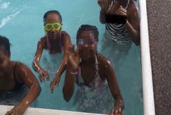 Air Kolam Kebanyakan Klorin, Kulit 5 Bocah Ini Terbakar Usai Berenang