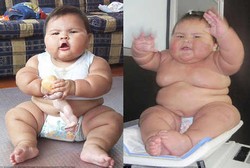Bobot 20 Kg di Usia yang Baru 10 Bulan, Ada Apa dengan Bayi Ini?